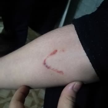 Altındağ Belediyesi Sokak Köpekleri Sorunu!