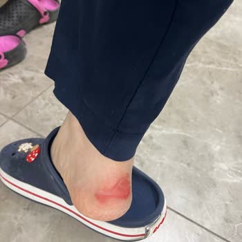 LCW Ayakkabı Ayaklarımı Mahvetti