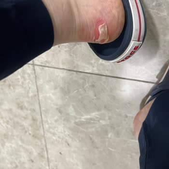 LCW Ayakkabı Ayaklarımı Mahvetti