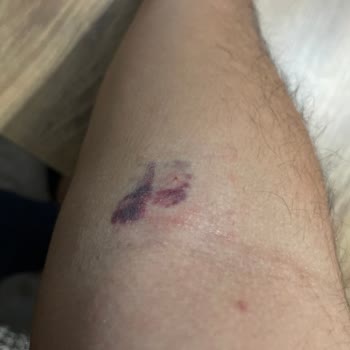 Türk Kızılay Zonguldak Kan Toplama Merkezi