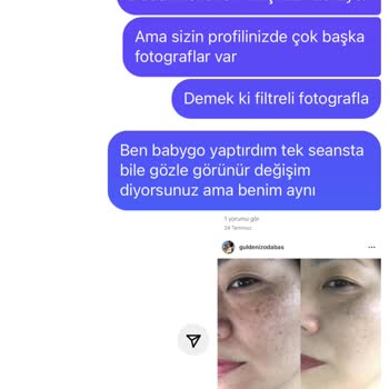 Güldeniz Odabaş Güzellik Merkezi Hayal Kırıklığına Uğratan Hizmet