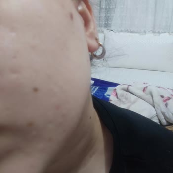 Dermoskin Arbutin Serum Ve Aha Bha