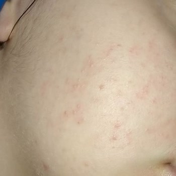 Bioderma Yüz Yıkama Jeli Şikayet