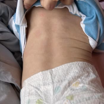 Andaç Eczanesi (Gaziemir) Yanlış Ürün Verilmesi Ve İlgisiz Tavır