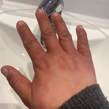 Pril Bulaşık Deterjanı Ellerimi Çürüttü