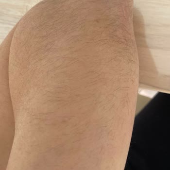 Aden Beauty Estetik Ve Güzellik Merkezi Ankara Memnuniyetsizliği!