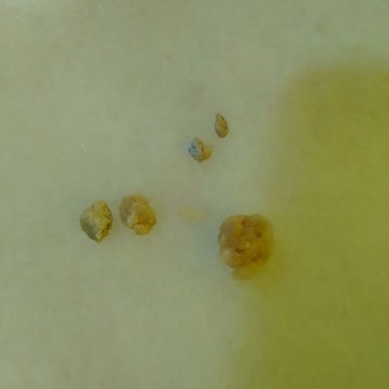 A101'den Ovadan Pirinç Böcekli