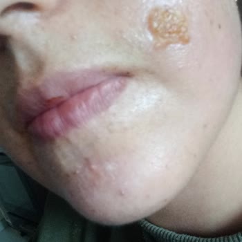 Nouvelle Vie Güzellik Merkezi Lazer Epilasyon