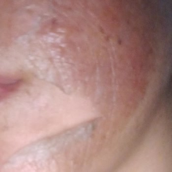 Nouvelle Vie Güzellik Merkezi Lazer Epilasyon