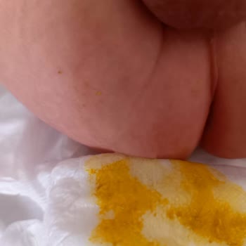 Sleepy Bebek Bezi Bebeğin Poposuna Yapışma Sorunu