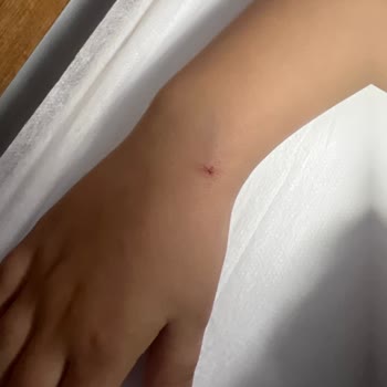 Özel Büyükşehir Hastanesi Hemşire Personelin Profesyonel Olmayan Tutumu