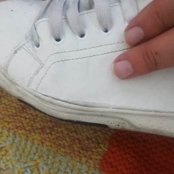 Zara'dan Aldığım Ayakkabının 1 Ay Olmadan Deforme Olması