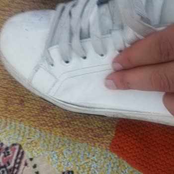 Zara'dan Aldığım Ayakkabının 1 Ay Olmadan Deforme Olması