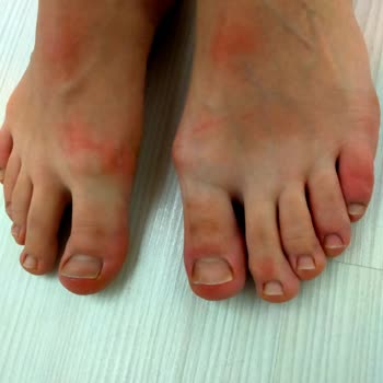 Elle Ayakkabı Aşırı Rahatsız Bot Mağduriyeti