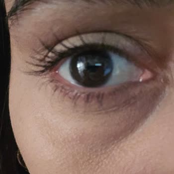 Maybelline New York Göz Altı Kapatıcısında Yan Etki!