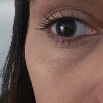 Maybelline New York Göz Altı Kapatıcısında Yan Etki!