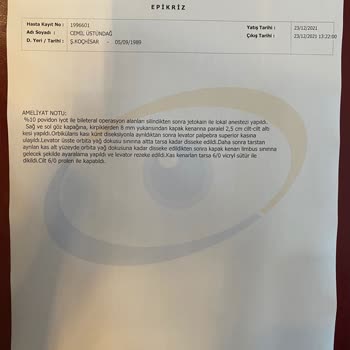 Veni Vidi Göz Sağlık Grubu Göz Kapağı Ameliyatı