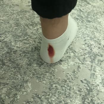 Boyner İade İstediğim Ürüne Tadilat Yapıp Göndermiş!