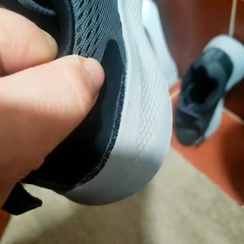 Skechers İle Yine Hüsran