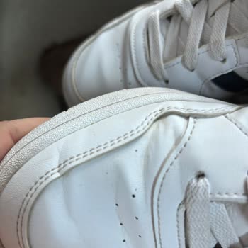 Hasarlı Ürün Sorunu (adidas)