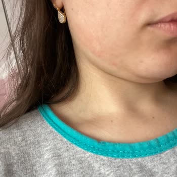Gratis Ve Loreal Paris İademi Yapmıyor Dönüş Sağlamıyor