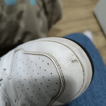 Deichmann Soyulma Ve Çatlak