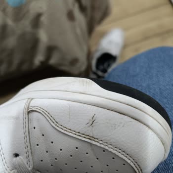 Deichmann Soyulma Ve Çatlak
