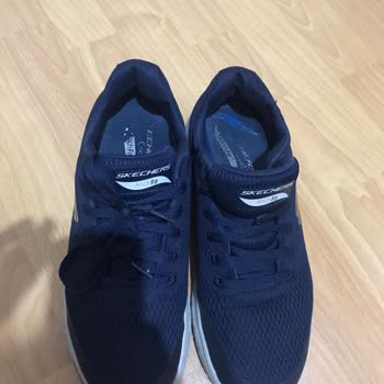 Skechers Taban Ve Topuk Deforme Mağduriyeti