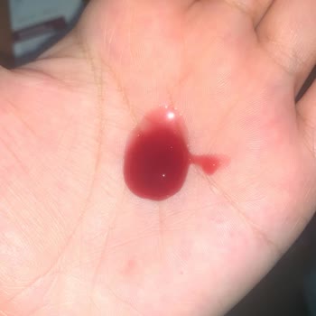 The Purest Solutions Ürün Pıhtılaşması Neyden Kaynaklı