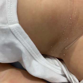 Molfix Bezden Şikayetçiyim Çocuğumun Sağlığı Tehlikeye Atılıyor