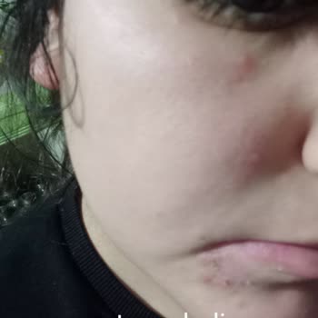 Vione Mağdurluk Abidesi Bir Ürün