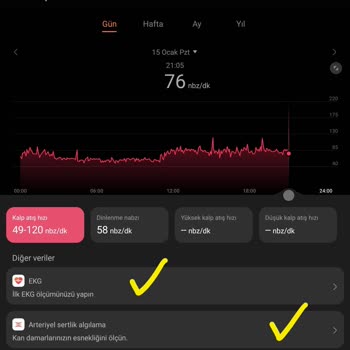 Huawei Gt4 Tansiyon Ve EKG Yok