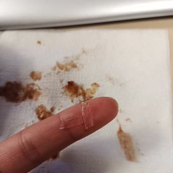 Gülümoğlu Baklava & Restaurant Tatlının İçinden Plastik Parçaları Çıktı