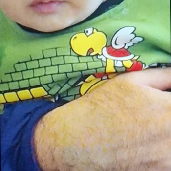 Samsung Telefon Akıllı Telefon Kamerasının Renk Dengesizliği Sorunu