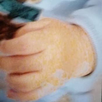 Samsung Telefon Akıllı Telefon Kamerasının Renk Dengesizliği Sorunu