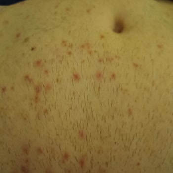 Veet Tüy Dökücü Krem