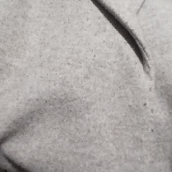 H&M Kaban Tüylenme Problemi Ve Bunu Kabul Etmemesi