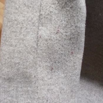 H&M Kaban Tüylenme Problemi Ve Bunu Kabul Etmemesi