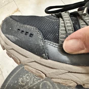 Skechers Ayakkabım 1 Sene İçinde Dağıldı