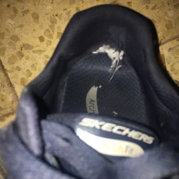 Hatalı Kalitesiz Skechers Ayakkabısı