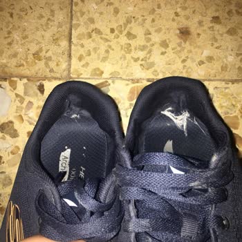 Hatalı Kalitesiz Skechers Ayakkabısı