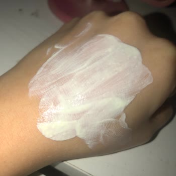Cosmed Yanma Ve Pürüz