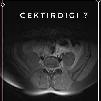 Tekirdağ Şehir Hastanesi Doktorları Çok İlgisiz!