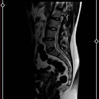 Tekirdağ Şehir Hastanesi Doktorları Çok İlgisiz!