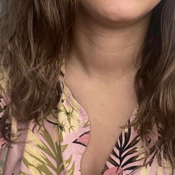 Eylül Öztürk TEM Avrupa Saç Kesim Renklendirme Mağduru