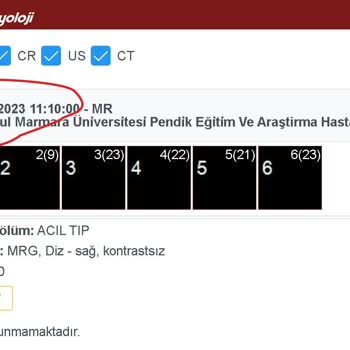 Marmara Üniversitesi Pendik Eğitim ve Araştırma Hastanesi MR Sonucunun Raporlanma Sürecinde Yaşanan Gecikme
