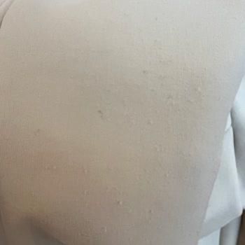 Oysho Ürün Deformasyonunda Garanti Hakkımı Kullanmama İzin Verilmedi