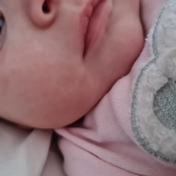 Orzax İlaç Bebeğimin Alerji Sorunu Ve Uyku Problemi