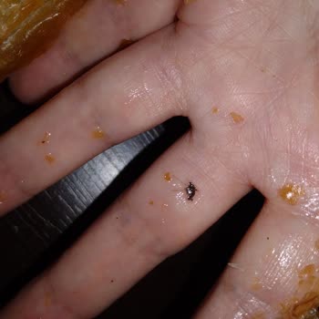 Böreğinden Böcek Çıkan Levent Börek