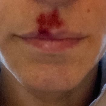 Gratis'ten Aldığım Bee Beauty Ağda Bandı